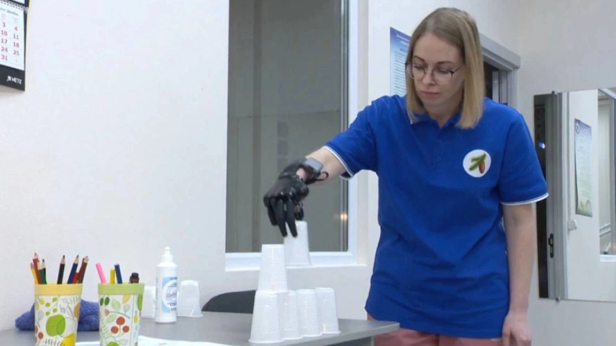В Ноябрьске впервые изготовили бионический протез руки
