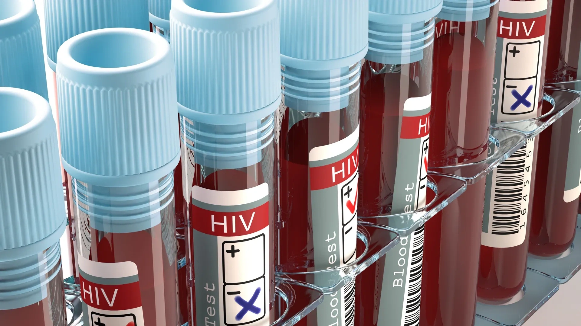 В Ноябрьске 28 ноября горожане могут пройти тестирование на ВИЧ